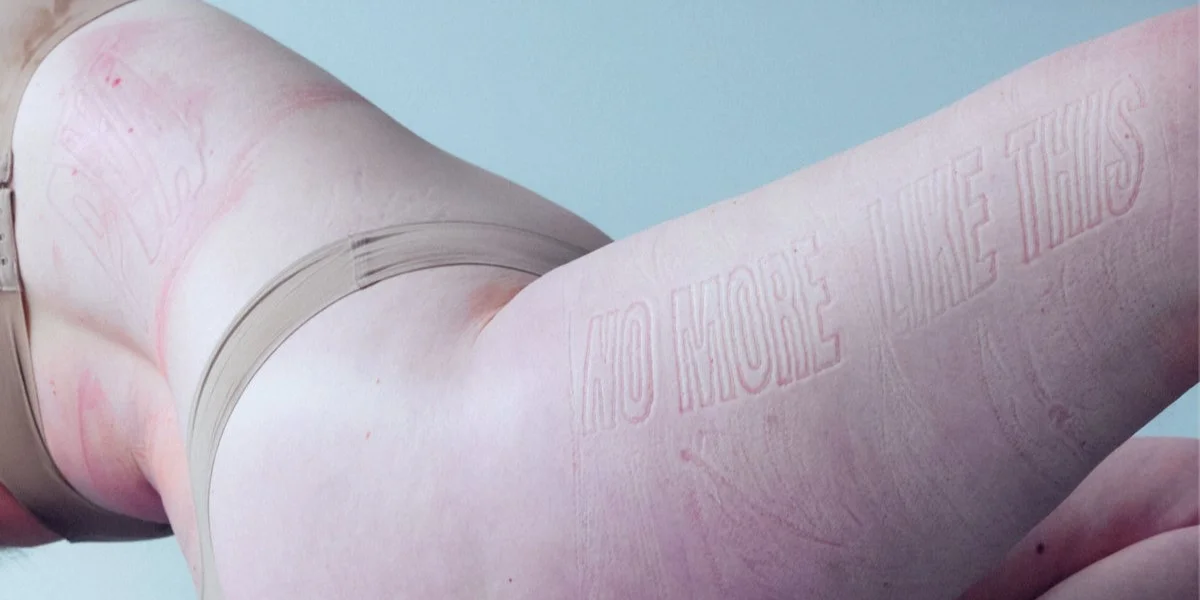 Esou net méi! | © PVA